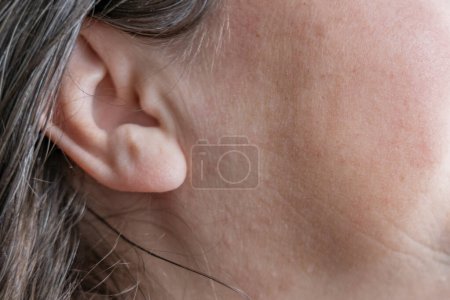 caucasian mature woman holding painful ear close up, hearing loss, Ear Discomfort, Hearing Test, Women's Health, Acute Otitis Media, Treatment and Care, Diagnosing and Treating, Preventing Ear Issues