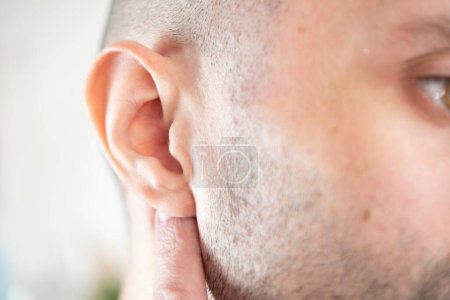 Kaukasischer junger Mann mit schmerzhaftem Ohr aus nächster Nähe, Hörverlust, Ohrbeschwerden, Hörtest, akute Otitis, Behandlung und Pflege, Vorbeugung von Ohrproblemen