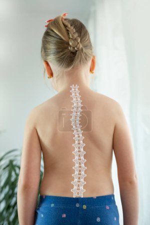 Rücken des Mädchens, Kind im Alter von 5 Jahren gebogene Wirbelsäule, Schmerzen in der Wirbelsäule, therapeutische Massage bei Osteochondrose, Skoliose, Rückenschmerzen, Bandscheibenvorfall