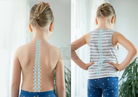 Verschiedene Ansichten Gesunder Rücken in mehreren Haltungen, fünfjähriges Kind, junges Mädchen steht mit geradem Rücken, gesunde Haltung, normale Wirbelsäule