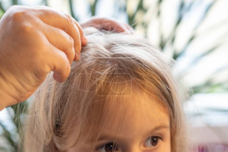 Close-up child's head with female hands searching for lice and nits in hair, doctor's fingers, Pediculosis infestation, Medical Examination