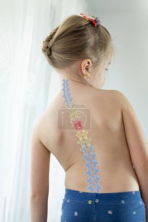 Rücken kleines Mädchen, Kind 5 Jahre alt schief stehend, gebeugt vor Rückenschmerzen, therapeutische Massage bei Osteochondrose, Skoliose, Bandscheibenvorfall