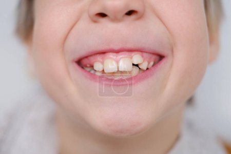 Jung Lächelndes Kind, Junge, Alter 10 zeigt wachsende Zähne, markiert Meilenstein in der zahnärztlichen Entwicklung, zeigt weiße gesunde Zähne, Mundhygiene