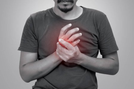 Foto de A man pain palm hand symptoms because arthritis. - Imagen libre de derechos