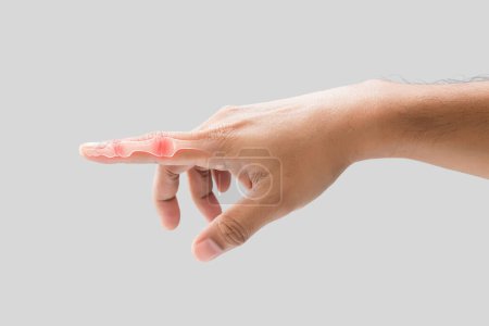 Foto de Inflamación del dedo índice y la articulación sinovial. sobre un fondo gris. - Imagen libre de derechos