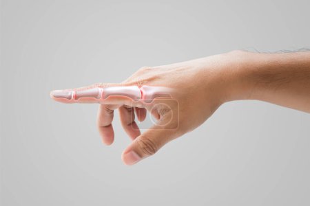 Foto de Inflamación del dedo índice y la articulación sinovial. sobre un fondo gris. - Imagen libre de derechos