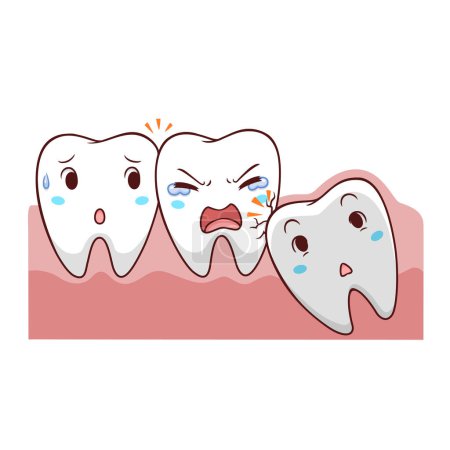 Illustration for Cartoon impacted tooth in the gum. - Royalty Free Image