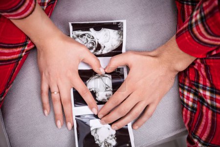 Photo for An usg photo of a baby lies on a gray sofa. A woman and a man put their hands on the usg photo, forming a heart shape from their palms. The parents-to-be are wearing the same plaid pajamas. - Royalty Free Image