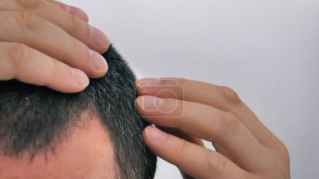 Photo for Male hair - close-up side view with gray hair, male hands touching head and hair. - Royalty Free Image