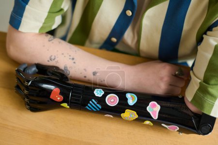 Téléchargez les photos : Gros plan des bras d'une jeune femme ayant une déficience physique ayant sa prothèse myoélectrique décorée d'autocollants faits à la main - en image libre de droit