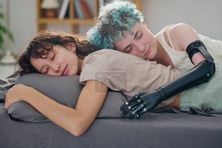 Téléchargez les photos : Jeune femme sereine avec la main myoélectrique embrassant sa petite amie pendant le sommeil alors que les deux couchés sur un lit double avec une literie grise - en image libre de droit