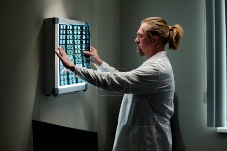 Téléchargez les photos : Oncologue masculin expérimenté en blouse de laboratoire regardant ct scanner du cerveau après examen du patient tout en se tenant dans le bureau médical - en image libre de droit