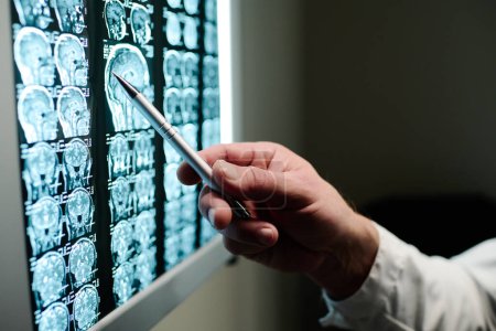 Foto de Mano de radiólogo masculino irreconocible con lápiz apuntando a la exploración cerebral en la pared en el consultorio médico de las clínicas modernas durante la discusión - Imagen libre de derechos