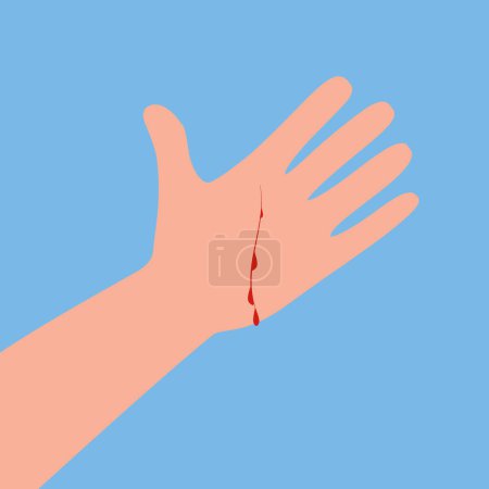 Wound on the hand palm. Red blood, infection in the cut. Skin injury. Idea of health treatment and first aid. Isolated vector illustration in cartoon style