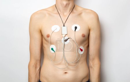 Téléchargez les photos : Dispositif Holter pour surveiller quotidiennement l "électrocardiogramme cardiaque du patient. - en image libre de droit