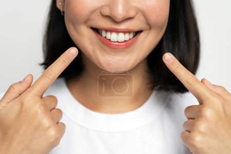 Porträt einer hübschen, fröhlichen Frau zeigt Zeigefinger auf Lächeln, zeigt weiße Zähne und blickt in die Kamera. Indoor-Studio isoliert auf weißem Hintergrund aufgenommen 