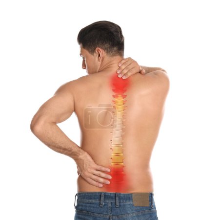Foto de Hombre sufriendo de dolor en la espalda sobre fondo blanco - Imagen libre de derechos