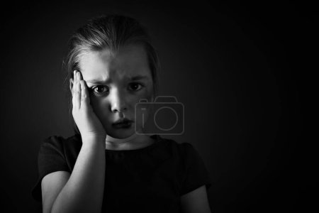 Photo for Little girl with bruises on face against dark background, space for text. Domestic violence victim - Royalty Free Image