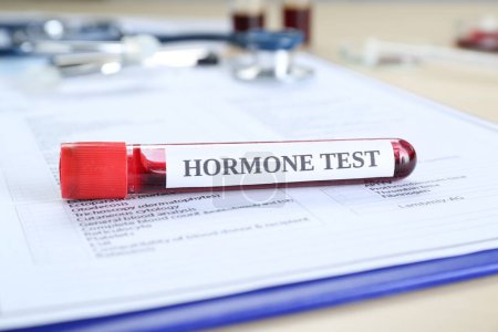 Téléchargez les photos : Test hormonal. Tube d'échantillon avec sang et forme de laboratoire sur la table, gros plan - en image libre de droit