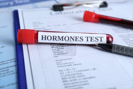 Téléchargez les photos : Test d'hormones. Tube d'échantillon avec du sang sur les formes de laboratoire - en image libre de droit