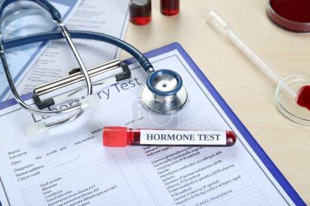 Hormone test. Sample tube with blood, stethoscope and laboratory form on table, above view