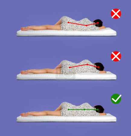 Photo for Collage with photos of woman lying on mattress. Wrong and correct sleeping posture. Choose right mattress - Royalty Free Image