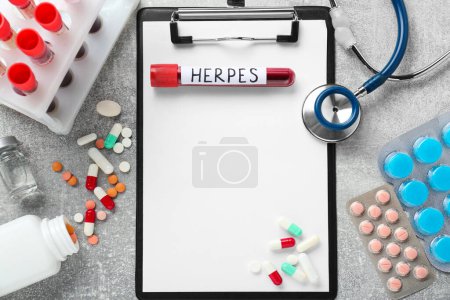 Photo for Test tube with word Herpes, different pills, clipboard and stethoscope on light grey table, flat lay. Space for text - Royalty Free Image