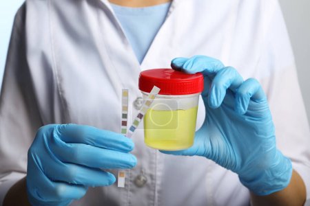 Arzt hält Behälter mit Urinprobe und Teststreifen zur Analyse, Nahaufnahme