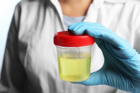 Arzt hält Behälter mit Urinprobe zur Analyse, Nahaufnahme