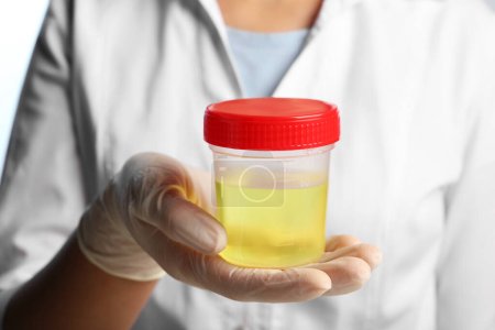 Arzt hält Behälter mit Urinprobe zur Analyse, Nahaufnahme