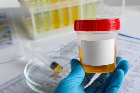 Photo for Nurse holding container with urine sample at table, closeup and space for text. Specimen collection - Royalty Free Image