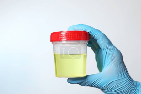 Photo for Doctor holding container with urine sample for analysis on white background, closeup - Royalty Free Image