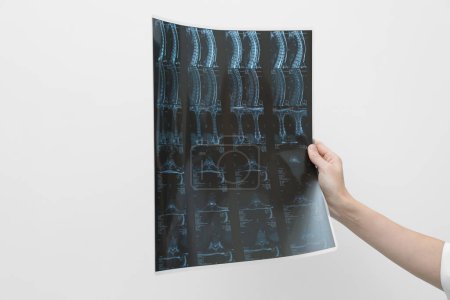 Foto de Médico examinando imagen de resonancia magnética del cuello sobre fondo gris claro, primer plano - Imagen libre de derechos