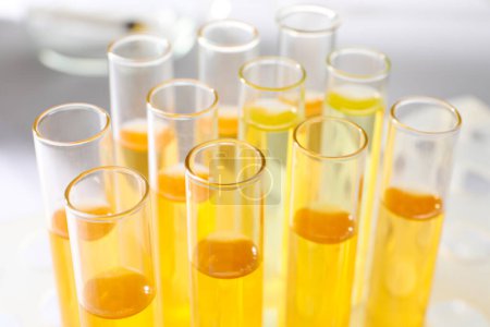 Photo for Tubes with urine samples for analysis on blurred background, closeup - Royalty Free Image