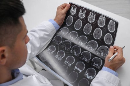 Téléchargez les photos : Médecin examinant des images IRM de patients atteints de sclérose en plaques à table blanche, gros plan - en image libre de droit
