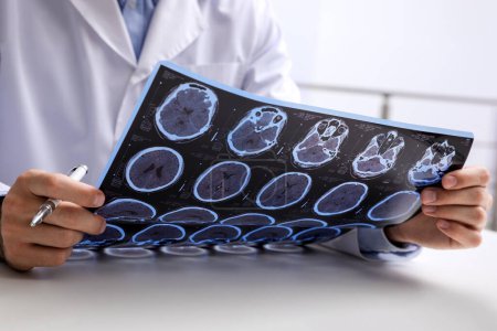 Foto de Médico examinando imágenes de resonancia magnética del paciente con esclerosis múltiple en la mesa en la clínica, primer plano - Imagen libre de derechos