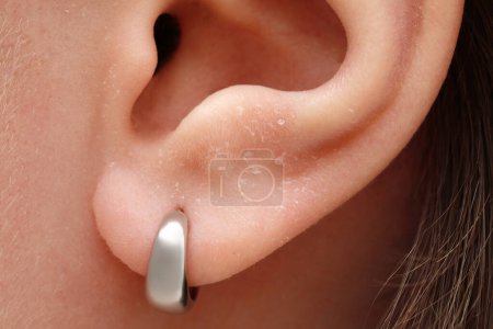 Photo for Woman with dry skin, closeup of ear - Royalty Free Image
