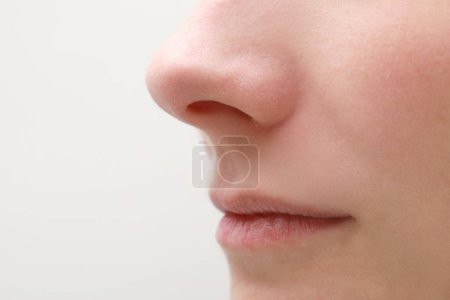 Photo for Woman with dry skin on white background, closeup of mouth - Royalty Free Image