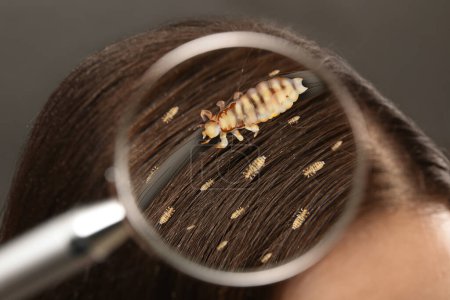 Photo for Pediculosis. Woman with lice and nits, closeup. View through magnifying glass on hair - Royalty Free Image