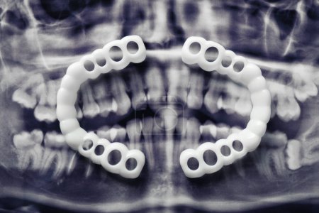 Photo for Mouth guards on dental scan, flat lay. Bite correction - Royalty Free Image