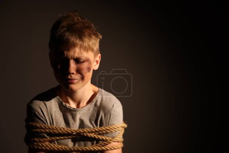 Photo for Little boy with bruises tied up and taken hostage on dark background. Space for text - Royalty Free Image