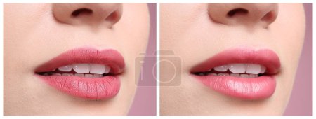 Téléchargez les photos : Collage avec des photos de femme avant et après l'utilisation du baume à lèvres sur fond rose, gros plan - en image libre de droit