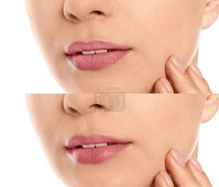 Téléchargez les photos : Collage avec des photos de femme avant et après l'utilisation du baume à lèvres sur fond blanc, gros plan - en image libre de droit