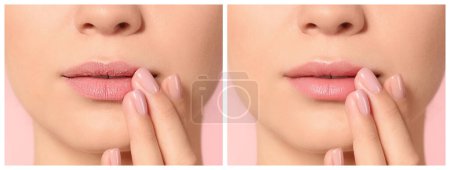 Téléchargez les photos : Collage avec des photos de femme avant et après l'utilisation du baume à lèvres sur fond rose, gros plan - en image libre de droit