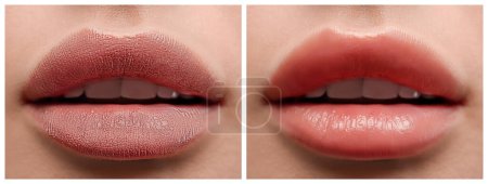 Téléchargez les photos : Collage avec des photos de femme avant et après application de baume cosmétique sur les lèvres, gros plan - en image libre de droit