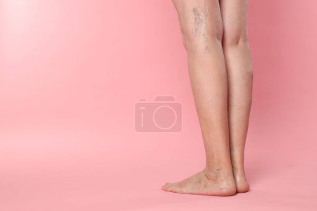 Closeup view of woman with varicose veins on pink background. Space for text