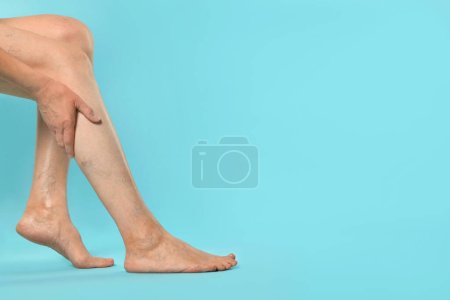 Closeup view of woman suffering from varicose veins on light blue background. Space for text