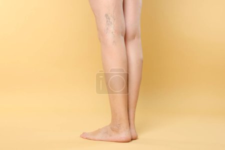Photo for Closeup view of woman with varicose veins on yellow background - Royalty Free Image