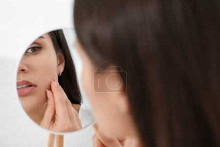 Photo for Young woman looking in mirror on her pimples indoors. Hormonal disorders - Royalty Free Image