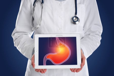 Foto de Tratamiento de la acidez y otras enfermedades gastrointestinales. Doctor con tableta sobre fondo azul oscuro, primer plano. Ilustración de estómago en pantalla - Imagen libre de derechos